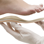 Ortopedia sanitaria del piede: i sintomi dell’alluce valgo