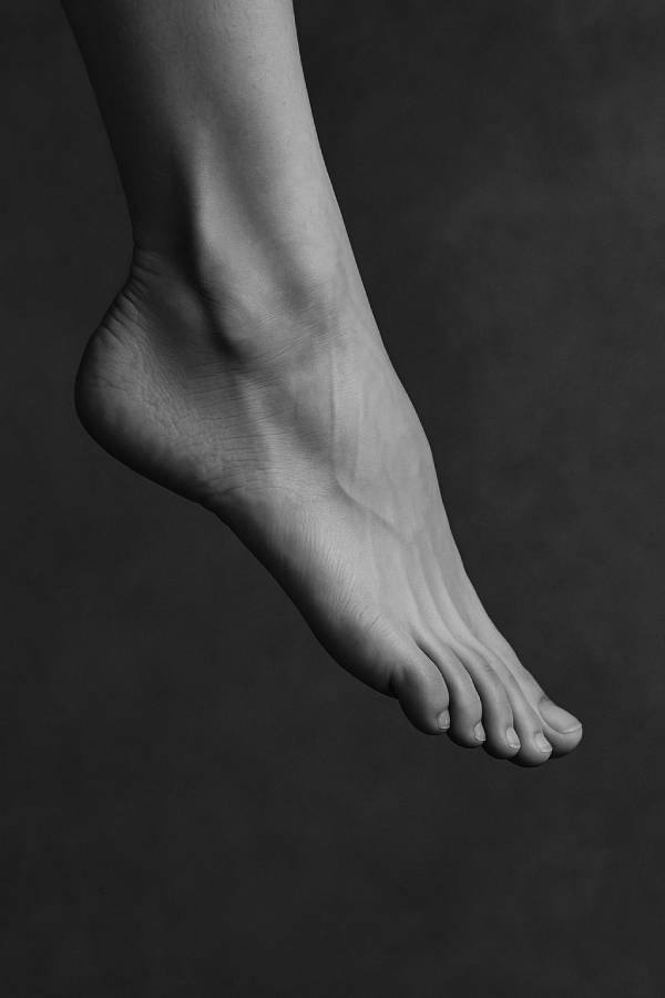 piede cadente e molla di codivilla